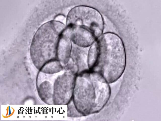 胚胎移植后hcg翻倍好为何还出血了