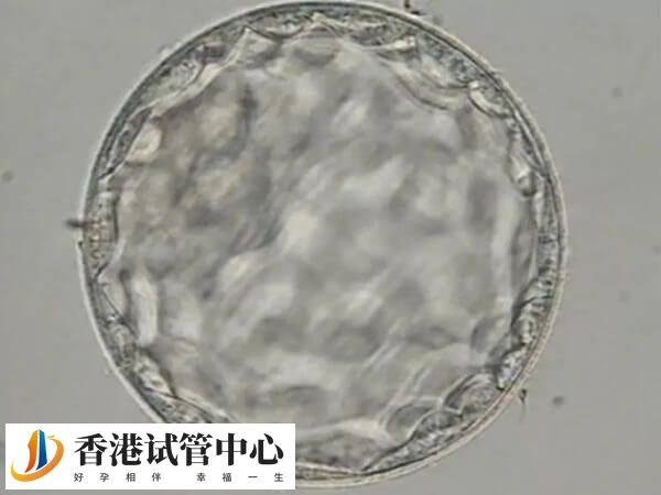 胚胎移植后hcg翻倍好但胸不涨很正常