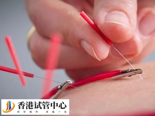 试管促排期间用电针好不好