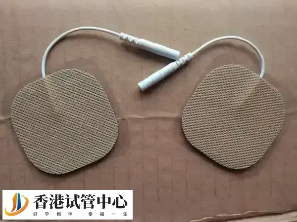 试管移植后做电针能够提高成功率