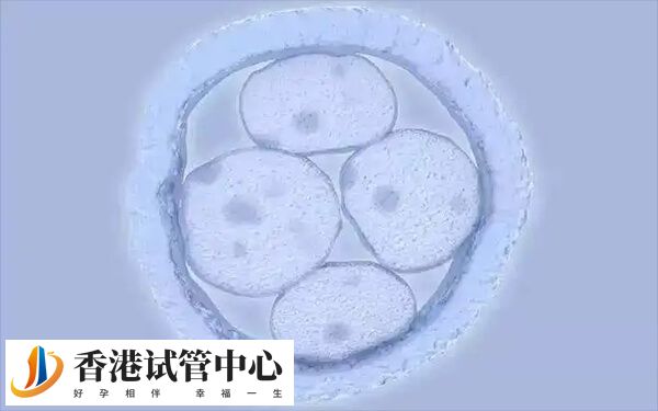 年龄是影响试管婴儿成功率中最重要的因素之一