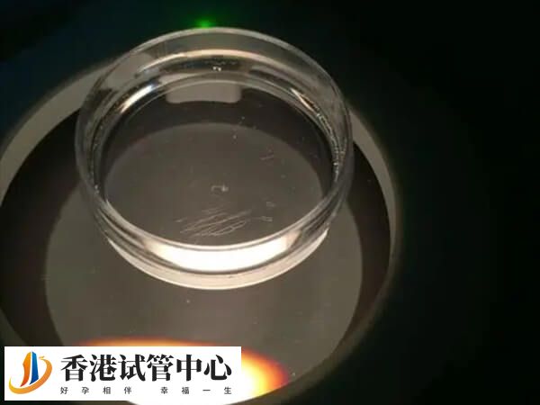 使用显微镜下取精成功率受多种因素影响